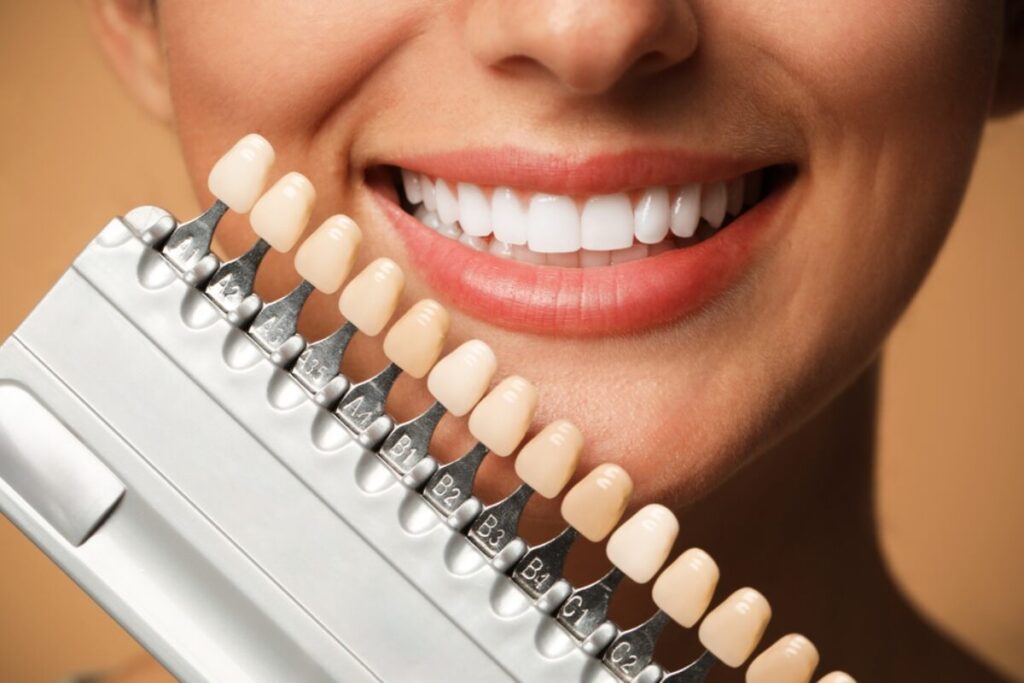 are dental veneers right for me